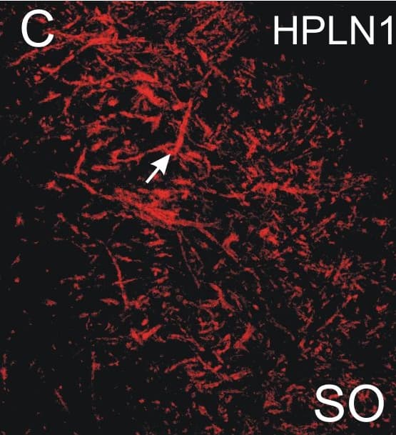 Detection of Human HAPLN1 by Immunocytochemistry/Immunofluorescence