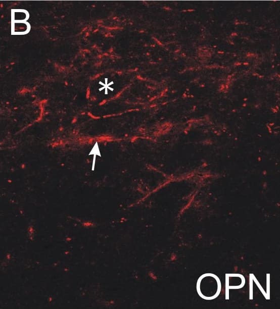 Detection of Human HAPLN1 by Immunocytochemistry/Immunofluorescence