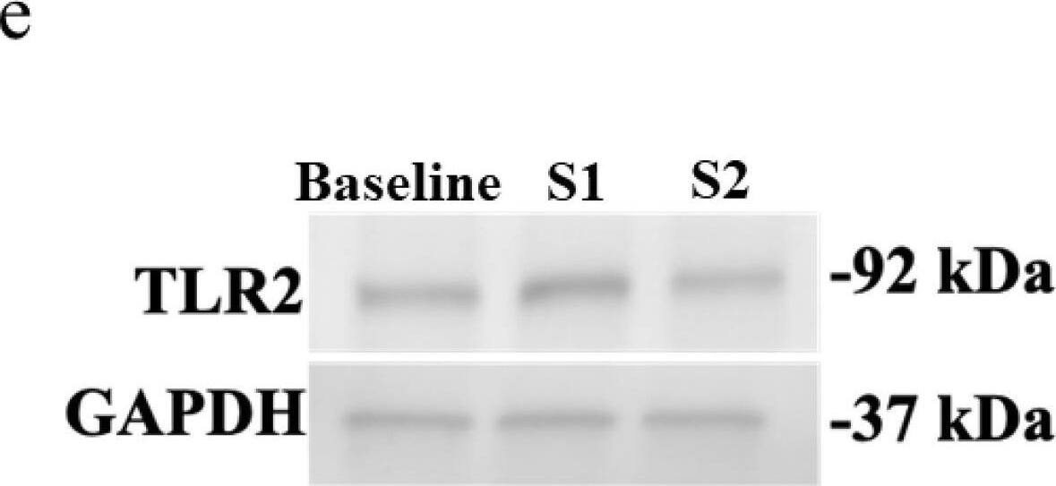 Detection of Human TLR2 by Western Blot