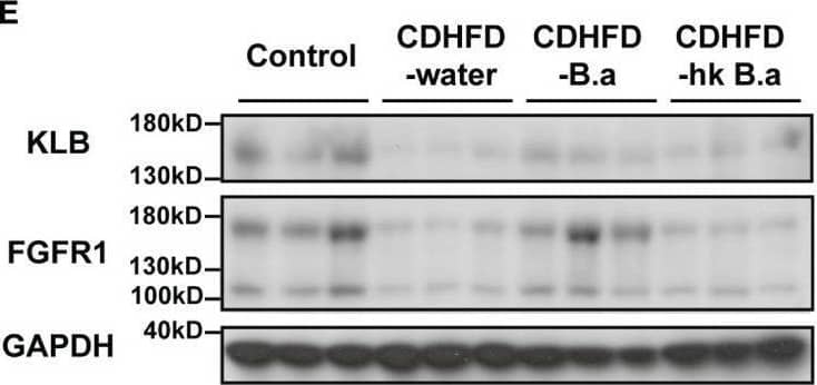 Detection of Klotho  beta by Western Blot