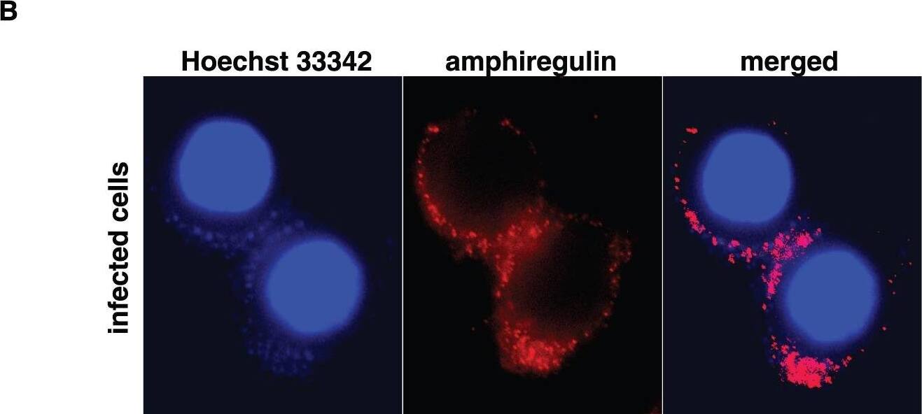 Detection of Amphiregulin by Immunocytochemistry/ Immunofluorescence