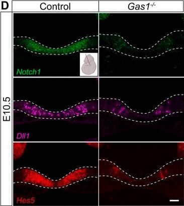 Detection of Gas1 by Immunohistochemistry