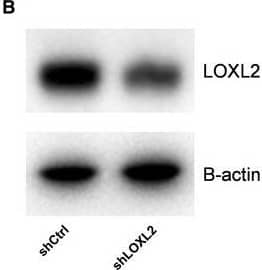 Detection of Human Lysyl Oxidase Homolog 2/LOXL2 by Knockdown Validated