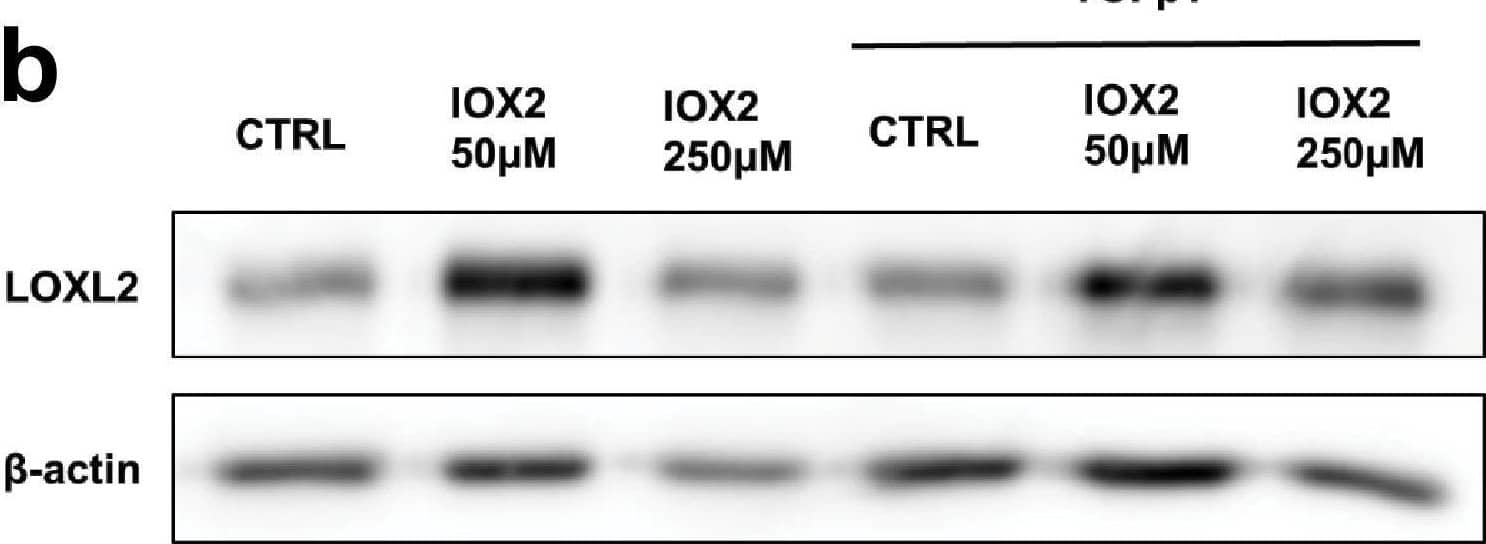 Detection of Human Lysyl Oxidase Homolog 2/LOXL2 by Western Blot