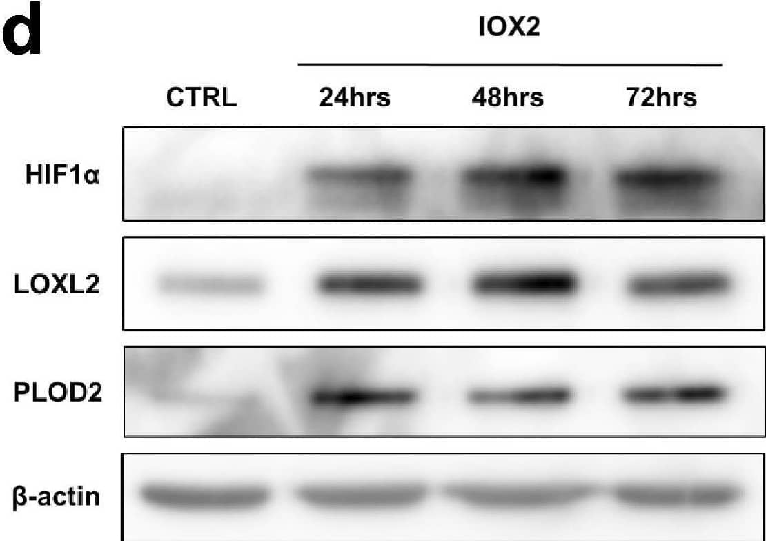 Detection of Human Lysyl Oxidase Homolog 2/LOXL2 by Western Blot