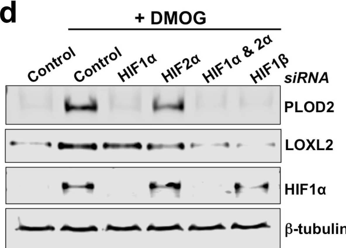 Detection of Human Lysyl Oxidase Homolog 2/LOXL2 by Western Blot