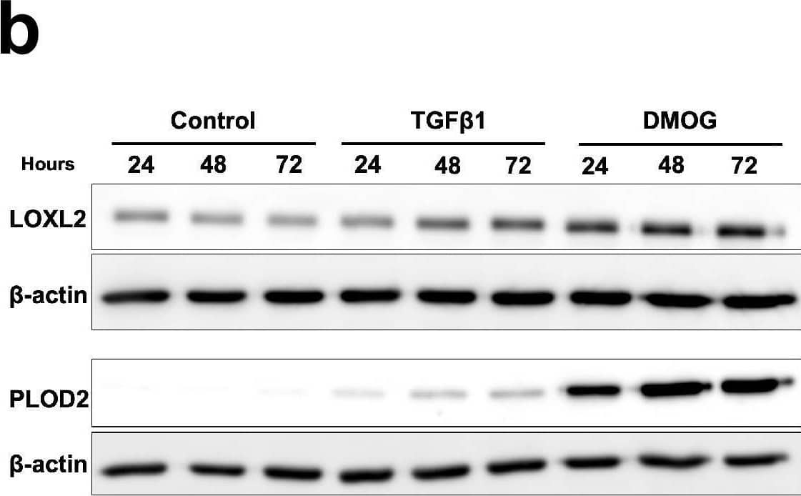 Detection of Human Lysyl Oxidase Homolog 2/LOXL2 by Western Blot