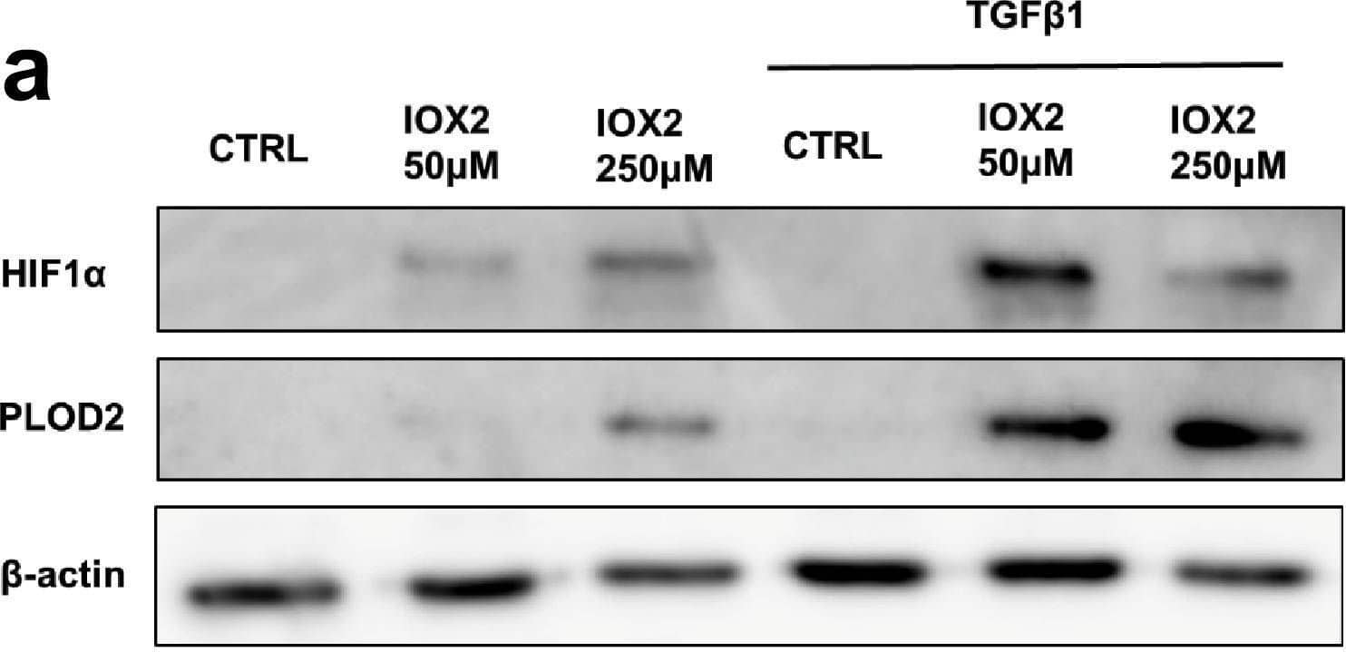 Detection of Human Lysyl Oxidase Homolog 2/LOXL2 by Western Blot