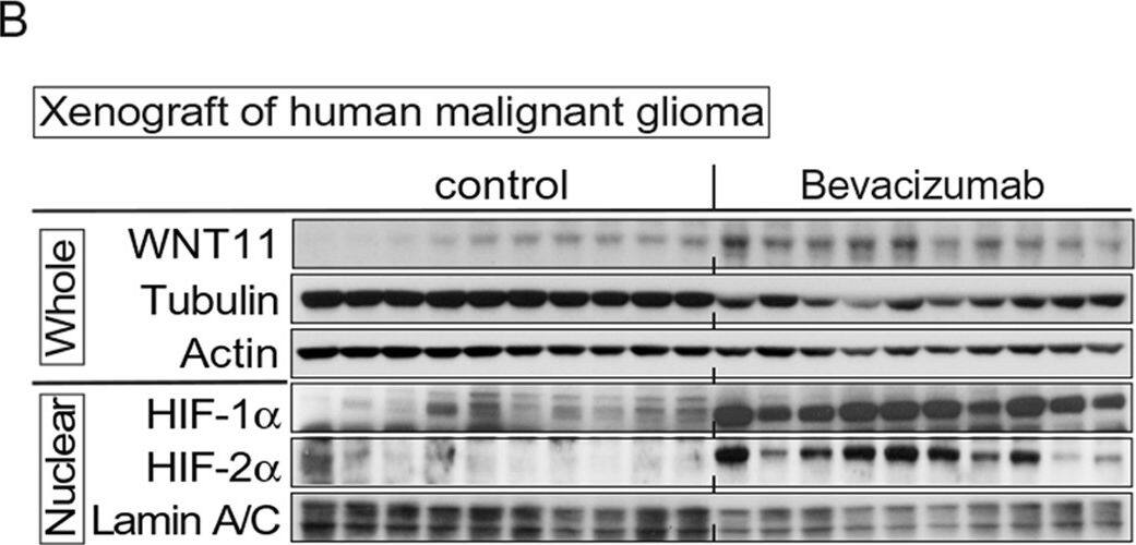 Detection of Human Wnt-11 by Western Blot