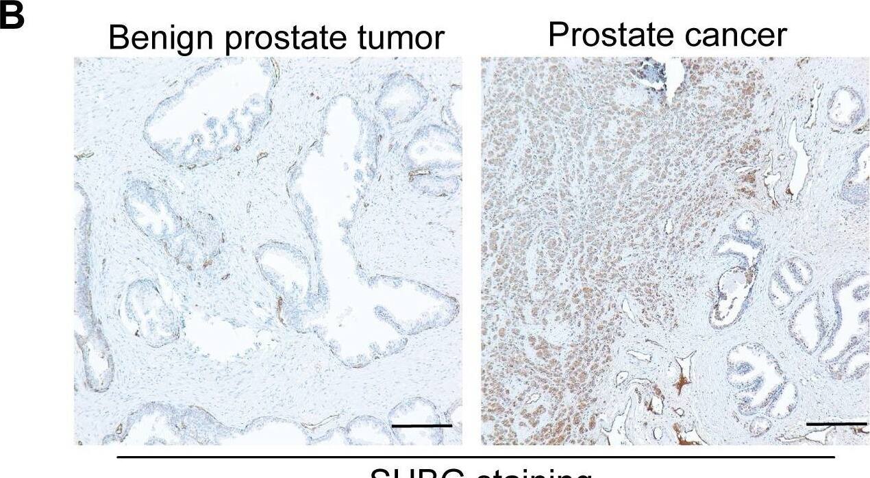 Detection of SHBG by Immunohistochemistry