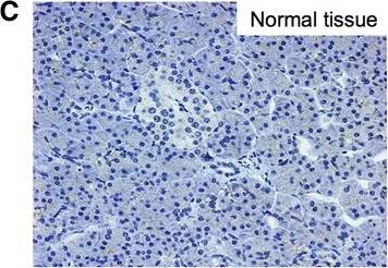 Detection of Human Nectin-4/PVRL4 by Immunocytochemistry/Immunofluorescence