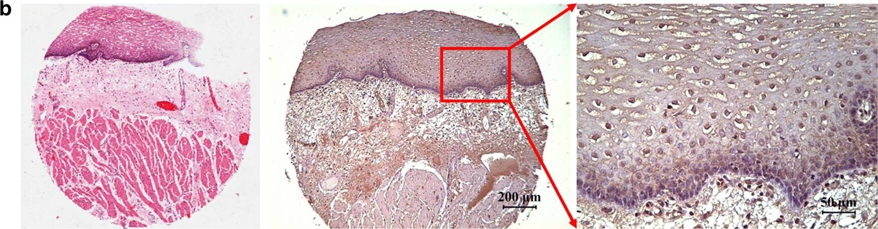 Detection of Human Nectin-4/PVRL4 by Immunohistochemistry