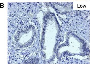 Detection of Human Nectin-4/PVRL4 by Immunocytochemistry/Immunofluorescence
