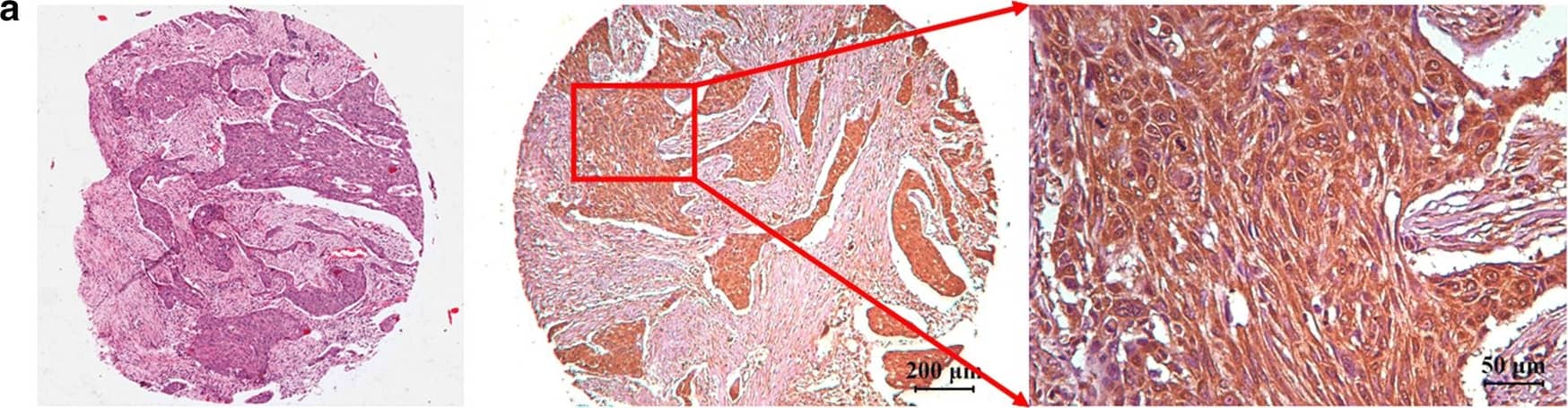 Detection of Human Nectin-4/PVRL4 by Immunohistochemistry