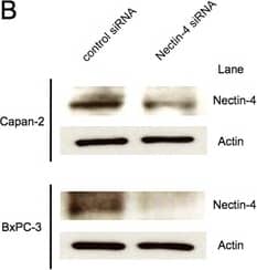 Detection of Human Nectin-4/PVRL4 by Western Blot