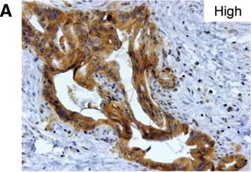 Detection of Human Nectin-4/PVRL4 by Immunocytochemistry/Immunofluorescence