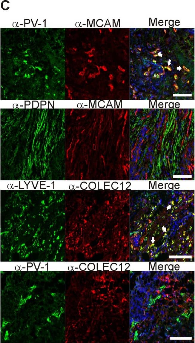 Detection of Human CL-P1/COLEC12 by Immunocytochemistry/Immunofluorescence