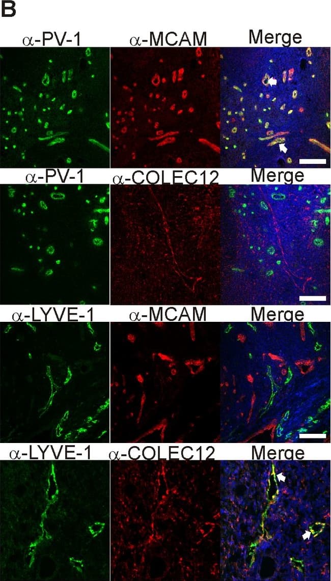 Detection of Human CL-P1/COLEC12 by Immunocytochemistry/Immunofluorescence
