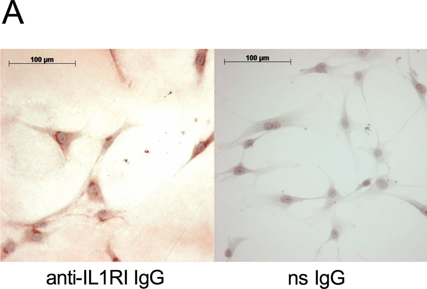Detection of Human IL-1 RI by Immunocytochemistry/ Immunofluorescence