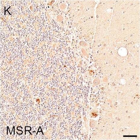 Detection of Human SR-AI/MSR by Immunohistochemistry