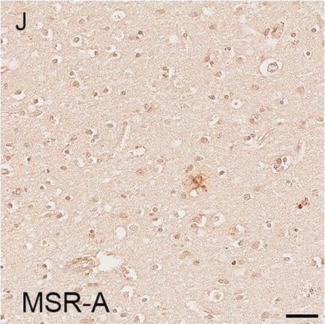 Detection of Human SR-AI/MSR by Immunohistochemistry