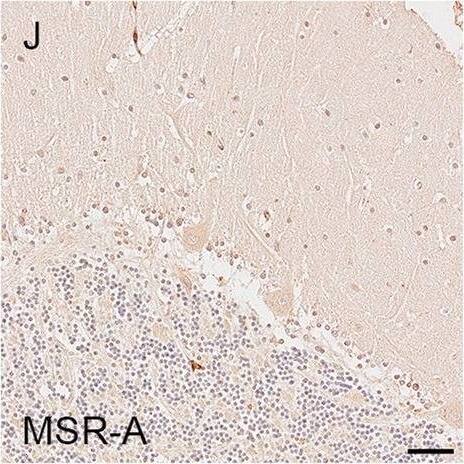 Detection of Human SR-AI/MSR by Immunohistochemistry