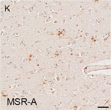 Detection of Human SR-AI/MSR by Immunohistochemistry