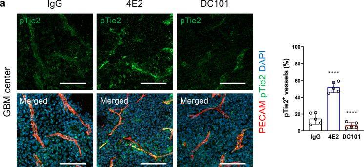 Detection of Phospho-Tie-2 (Y992) by Immunohistochemistry