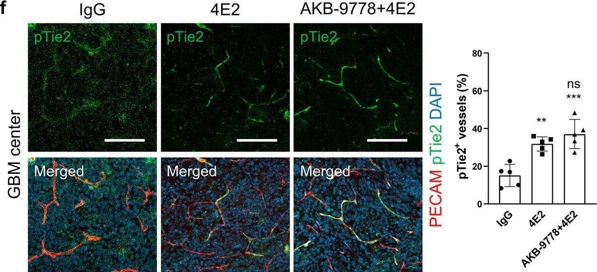 Detection of Phospho-Tie-2 (Y992) by Immunohistochemistry