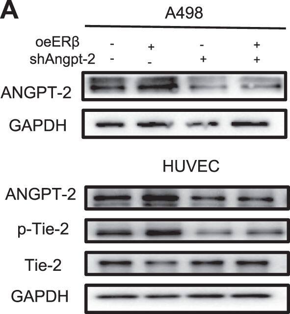 Detection of Phospho-Tie-2 (Y992) by Western Blot