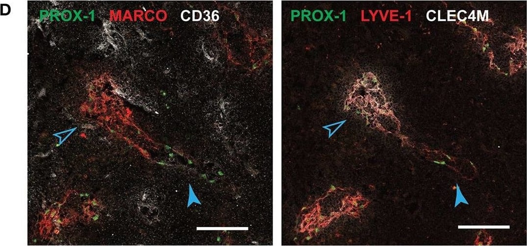 Detection of Human Prox1 by Immunocytochemistry/Immunofluorescence