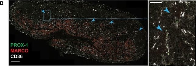 Detection of Human Prox1 by Immunocytochemistry/Immunofluorescence