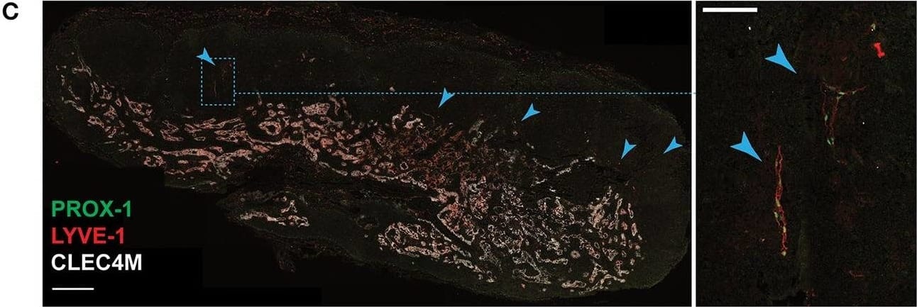 Detection of Human Prox1 by Immunocytochemistry/Immunofluorescence