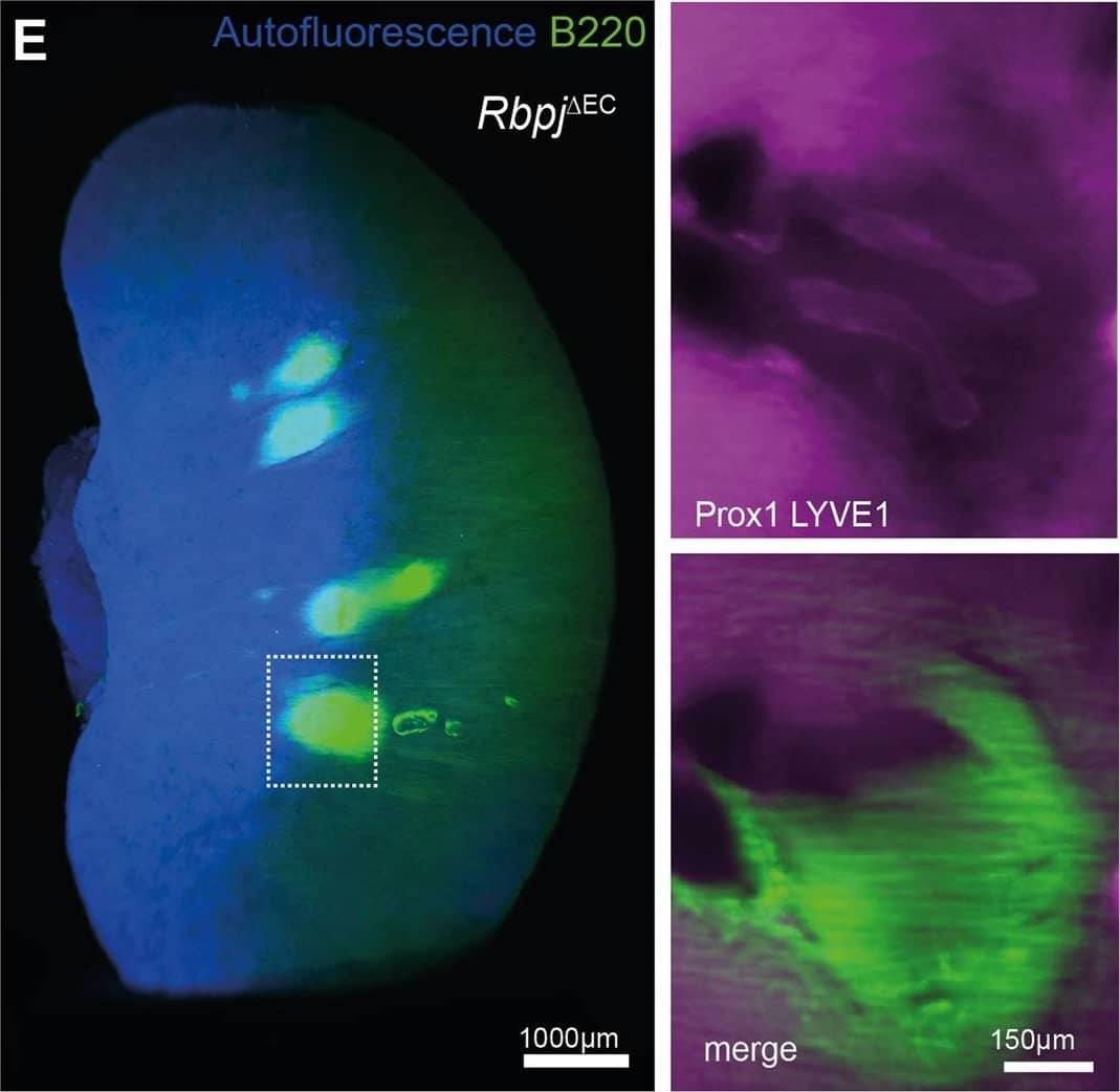 Detection of Mouse Prox1 by Immunohistochemistry