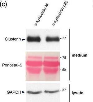 Detection of Human Clusterin/APOJ by Western Blot