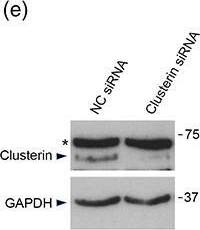Detection of Human Clusterin/APOJ by Western Blot