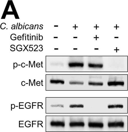 Detection of Human HGFR/c-MET by Western Blot