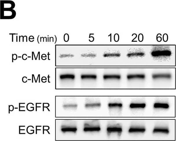 Detection of Human HGFR/c-MET by Western Blot