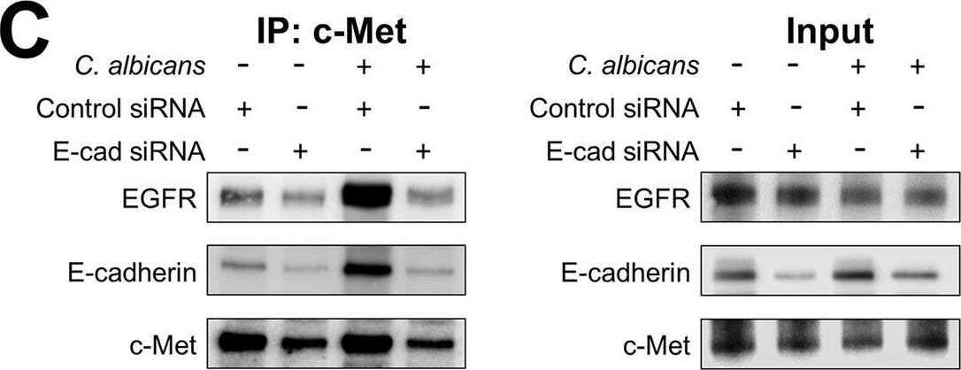 Detection of Human HGFR/c-MET by Western Blot