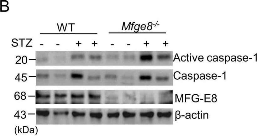 Detection of Human MFG-E8 by Western Blot