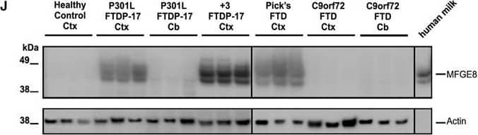 Detection of Human MFG-E8 by Western Blot