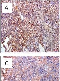Detection of Human Stanniocalcin 2/STC-2 by Immunohistochemistry