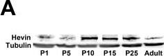 Detection of Mouse SPARC-like 1/SPARCL1 by Western Blot