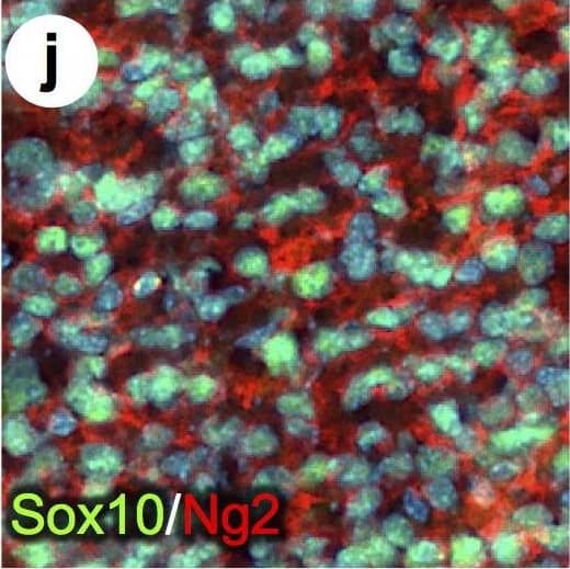 Detection of Mouse SOX10 by Immunohistochemistry