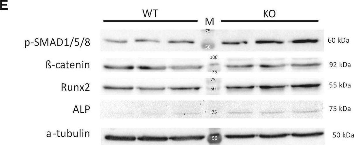 Detection of IL-9R by Western Blot
