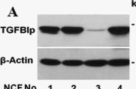 Detection of  betaIG-H3 by Western Blot