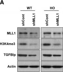 Detection of Human  betaIG-H3 by Western Blot