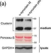Detection of Human Clusterin/APOJ by Western Blot