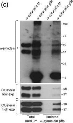 Detection of Human Clusterin/APOJ by Western Blot