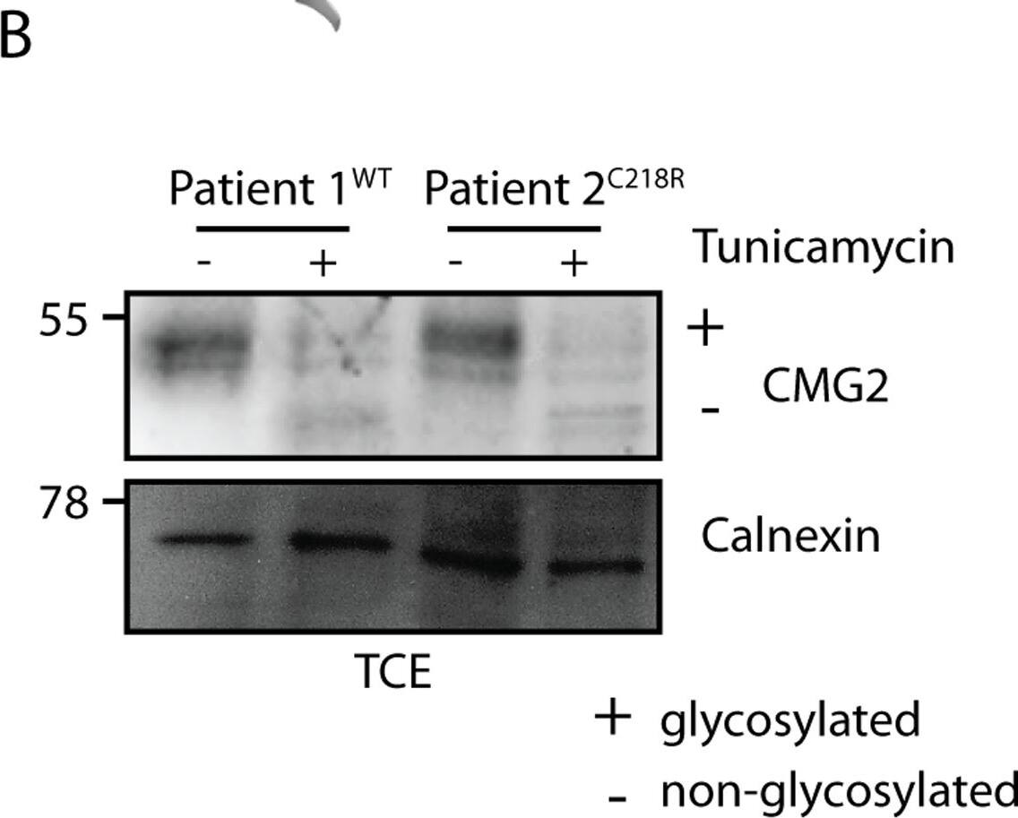 Detection of Human CMG-2/ANTXR2 by Immunoprecipitation